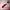 Trypanosoma Cruzi IgG