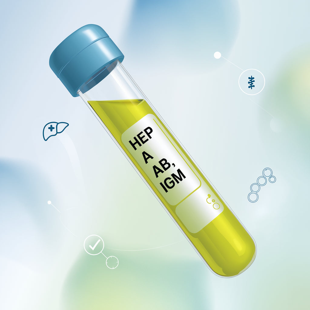Hep A Ab, IgM