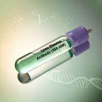 Lyme Disease Antibody w/Reflex to Blot (IgG, IgM)