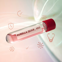 Rubella Quant Ab., IgG